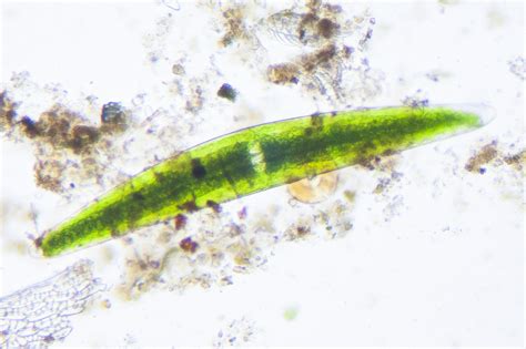 Closterium lunula | The Microscopic Life of Shetland Lochs