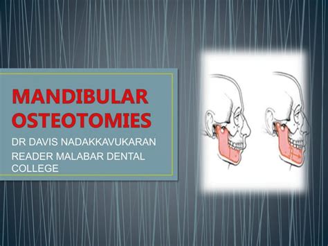 MANDIBULAR OSTEOTOMIES.pptx