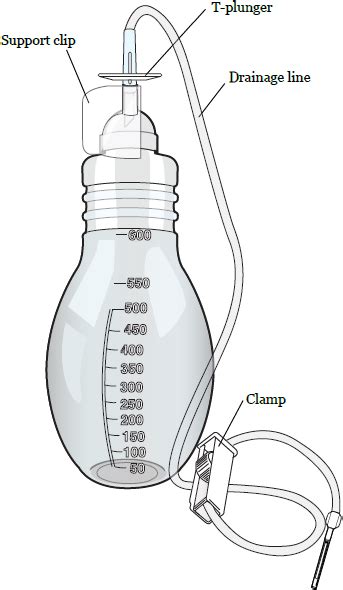 Pleurx Catheter Placement