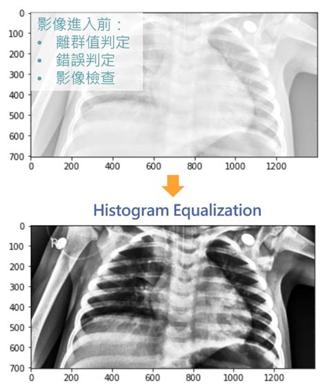 Ai醫學影像分析技術 工研院產業學習網