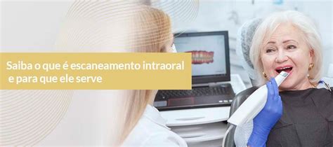 Saiba o que é escaneamento intraoral e para que ele serve Blog