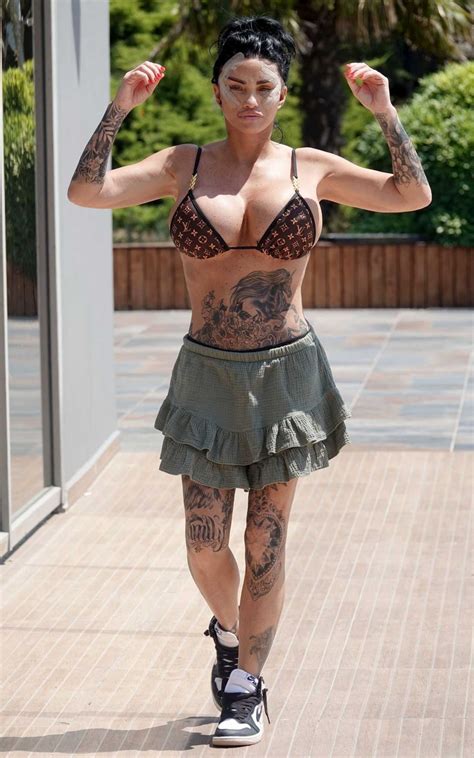 Katie Price In A Louis Vuitton Bikini Showing Her Heavily Bandaged Bruised Face Out In Turkey