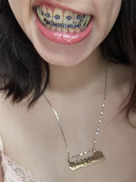 Cum For Me Pls R Amature Braces