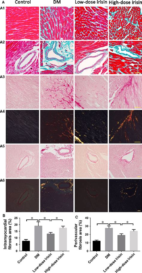 Effect Of R Irisin On Diabetes Induced Myocardial Fibrosis A1 A2