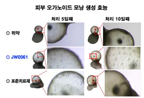 Jw중외제약 美서 Wnt 표적 탈모치료제 ‘jw0061 효능 공개 이투데이