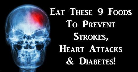 Eat These 9 Foods To Prevent Strokes Heart Attacks And Diabetes David Avocado Wolfe