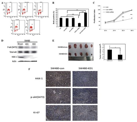 Expression Of Hax In Colorectal Cancer And Its Role In Cancer Cell Growth