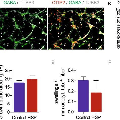 Short Term Read Out Of Neurite Outgrowth Growth Cone Formation And