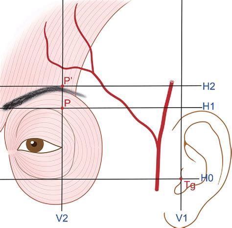 Temporal Artery Anatomy Anatomical Charts Posters