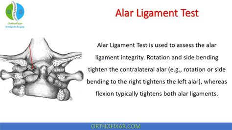 Alar Ligament Test Easy Explained OrthoFixar 2022 In 2022 Test