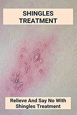 Shingles Treatment: Relieve And Say No With Shingles Treatment: Shingles On Face Treatment book ...