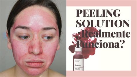 ¿el Peeling Solution Te Ordinary Funciona O Es Solo Fama Primera Vez