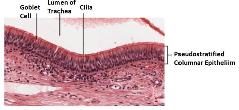 Describe In Detail That Can Be Seen In A TEM Of A Ciliated Epithelial