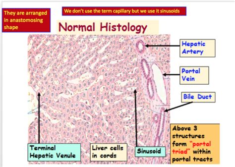 Pathology Of The Liver Flashcards Quizlet