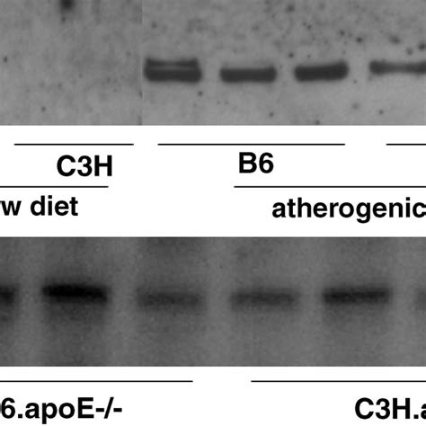 Western Blot Analysis Of Apolipoprotein B Apob Level In The Aortic