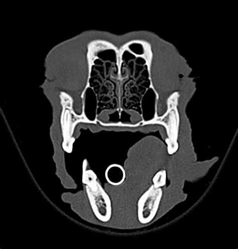 Lacrimal Fossa Location