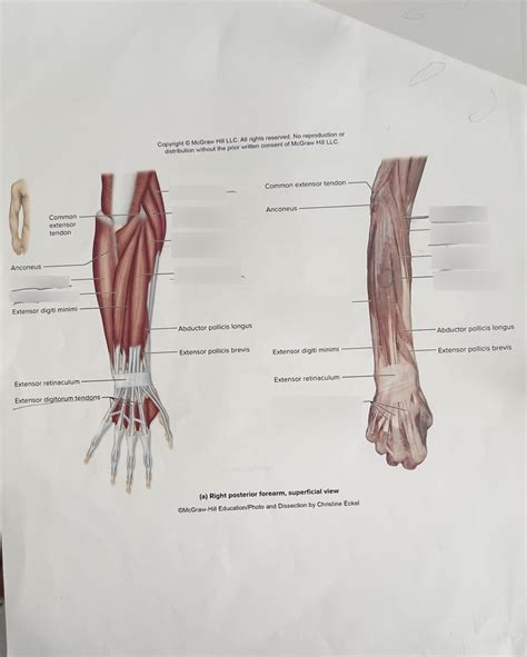 Right Posterior Forearm Diagram Quizlet