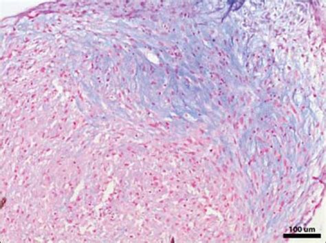 Alcian Blue Staining Confirming Chondrogenic Differentiation Of Ascs