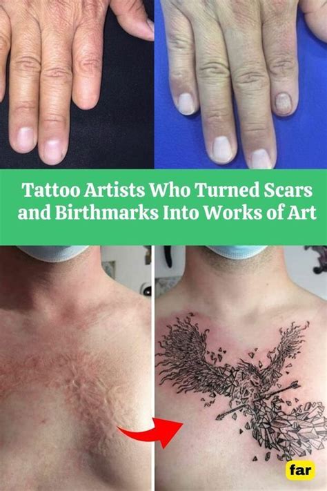 Tattoo Artists Who Turned Scars And Birthmarks Into Works Of Art Artofit