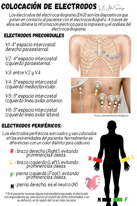 Ecg Como Colocar Os Eletrodos Braincp