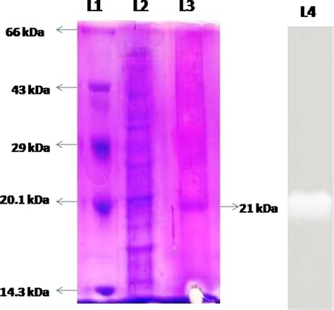 Sodium Dodecyl Sulfate Polyacrylamide Gel Electrophoresis Analysis Of