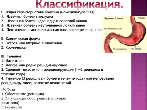 Язвенная болезнь желудка - презентация онлайн