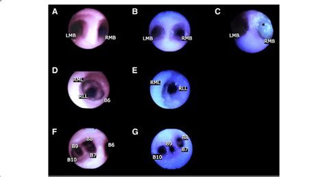 Upper row: bronchoscopic view of carina showing left mainstem bronchus... | Download Scientific ...