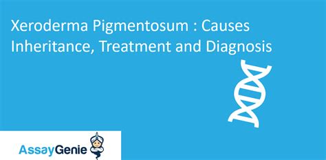 Xeroderma Pigmentosum Causes Inheritance Treatment And Diagnosis