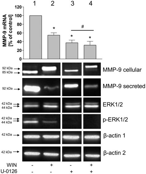 MMP 9 Quantitative Real Time PCR Bar Chart And Western Blot Analyses