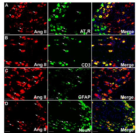 Figure From Attenuation Of The Infiltration Of Angiotensin Ii