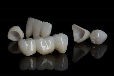 What Are The 3 Types Of Crowns Sabka Dentist Top Dental Clinic Chain In India Best