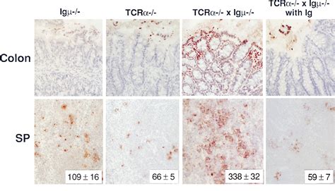 Figure From Suppressive Role Of B Cells In Chronic Colitis Of T Cell