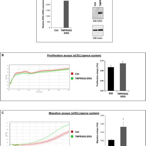 Tmprss Erg Fusion Increases Bone Metastasis Development A Schematic