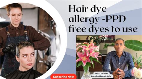 What You Need To Know About Hair Dye Allergy Including Ppd Free Dyes Youtube