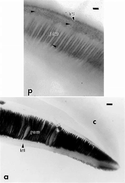 A Whole Mount In Situ Hybridization On A Gill Filament Of An Adult