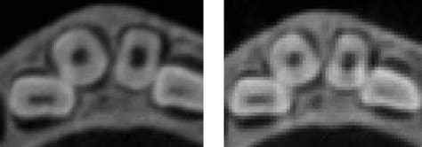 Cone Beam Ct Images With A Voxel Size Of M M Left And M M