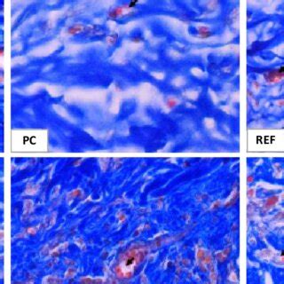 Photomicrograph Of The Cross Section Of Mice Skin From Each Treatment