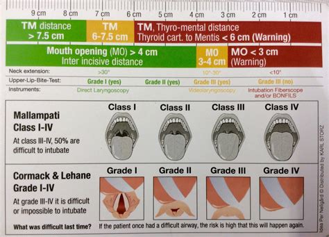 Crna School Anesthesia Passing Gas