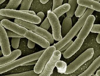 Klebsiella Urinary Tract Infection: Symptoms, Diagnosis and Treatment