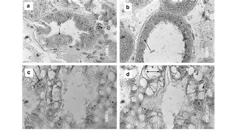 Histological Observations Of Hepatopancreas From White Shrimp Exposed Download Scientific