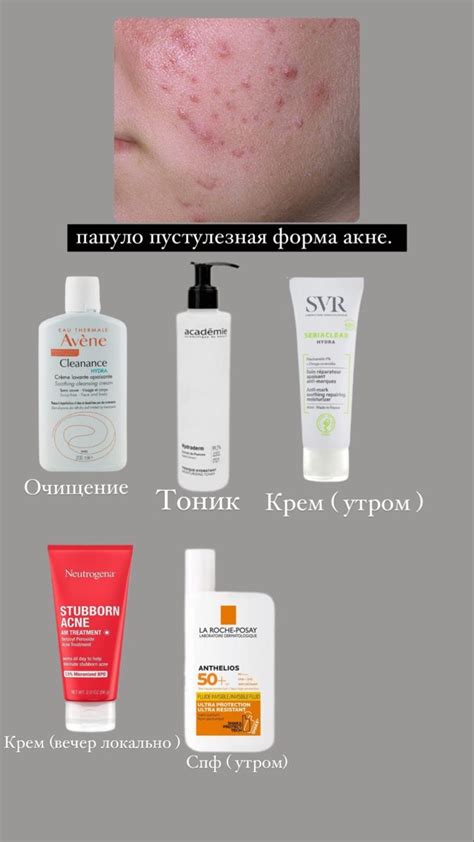 лечим прыщи | Skin cosmetics, Face products skincare, Face skin care ...