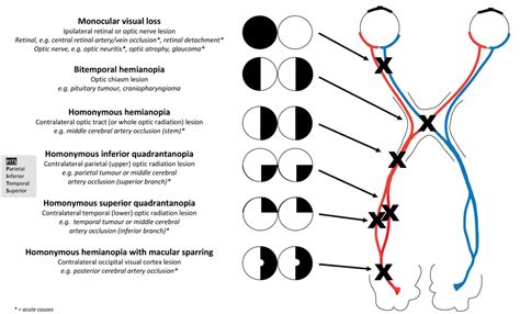 Visual System Examination OSCEstop OSCE Learning