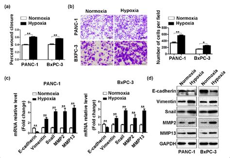 Hypoxia Promotes PDAC Cells Invasion Via EMT The Cells Were Cultured