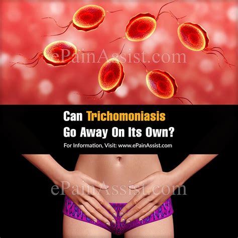 Can Trichomoniasis Go Away On Its Own Going Away Natural Treatments Health