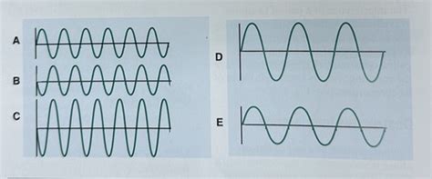 Ultrasound Physics The Basics Ch1 Sound Ch2 Flashcards Quizlet