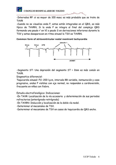 Taquicardia Supraventricular Pdf