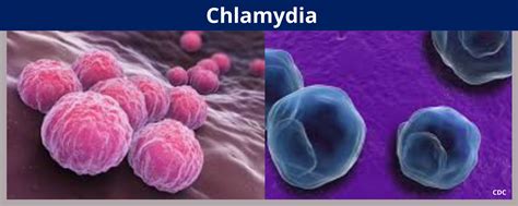 Chlamydia Benton Franklin Health District