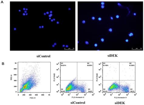 Knocking Down DEK Exacerbated The Apoptosis Of SW 620 Cells A