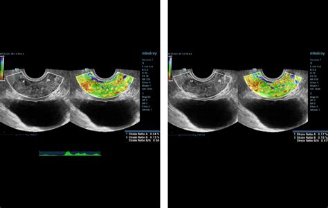 Ultrasound Journal An Example Of The Use Of Multiparametric