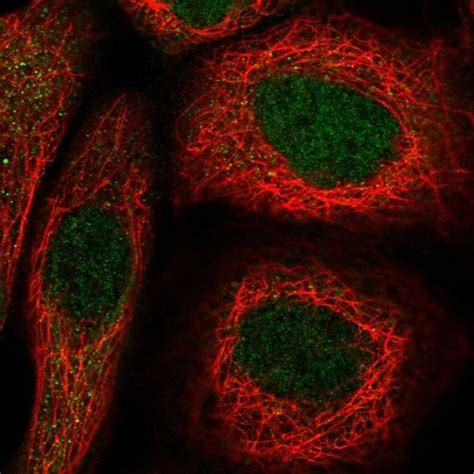 Mettl Polyclonal Antibody Invitrogen L Unconjugated Antik Rper